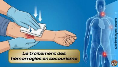 Le traitement des hémorragies en secourisme